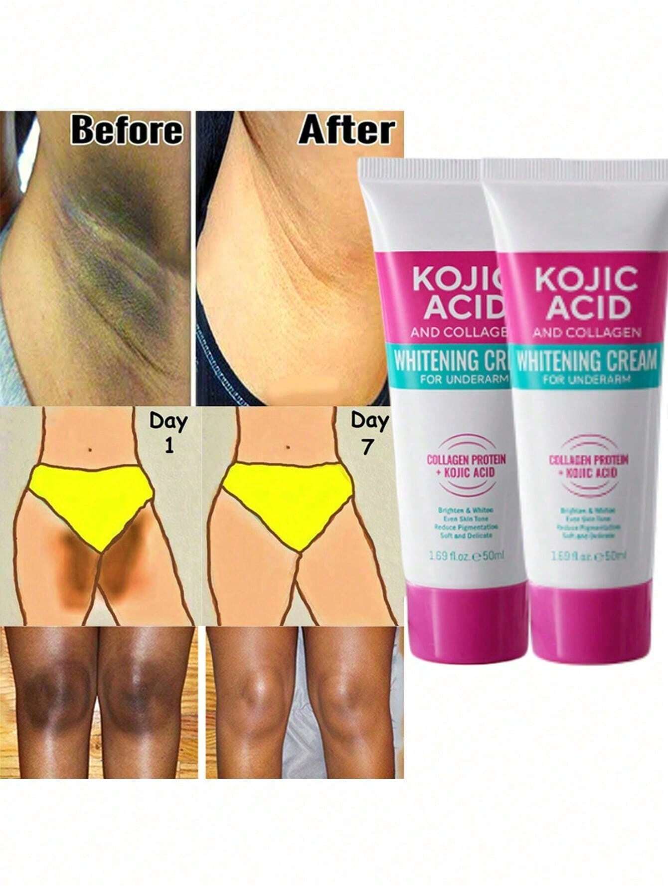 1pc/Underarm Whitening Cream to Remove Darkness of the Area. Whitening Cream for Armpits, Knees, and Moisturizing Cream, with Plant Extracts and Collagen. Whitening Cream, Moisturizing Cream for Black Area on the Skin